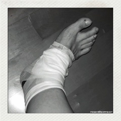 sprained_ankle